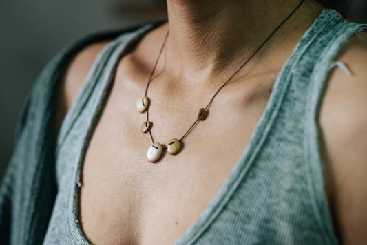 שרשרת אכזיב